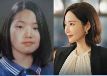 Inilah Deretan Selebriti Korea yang Berani Speak Up Melakukan Operasi Plastik