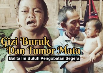 Buka Donasi Mendesak untuk Aneira Hazna Juliani