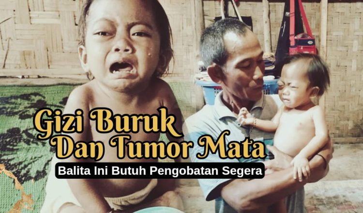 Buka Donasi Mendesak untuk Aneira Hazna Juliani