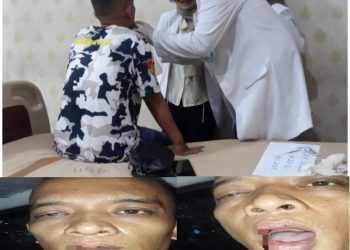 Diduga Dianiaya di Dalam Gereja, Warga Bandar Lampung Laporkan Mahasiswa Teologi ke Polisi